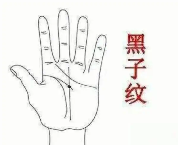 手相算命,手掌有黑子纹 黑子纹对一个人的影响很大,拥有这种手相的人
