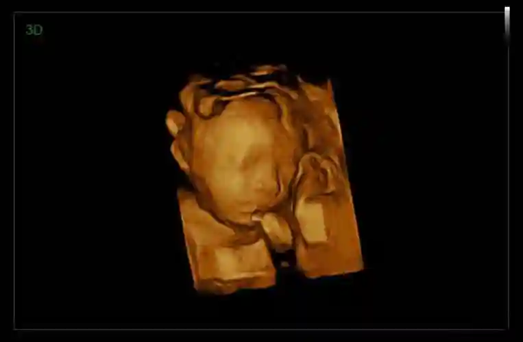 谁手里有四维彩超胎儿睾丸图片