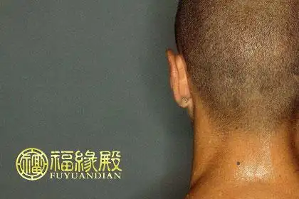 男人脖子后面有痣怎么看