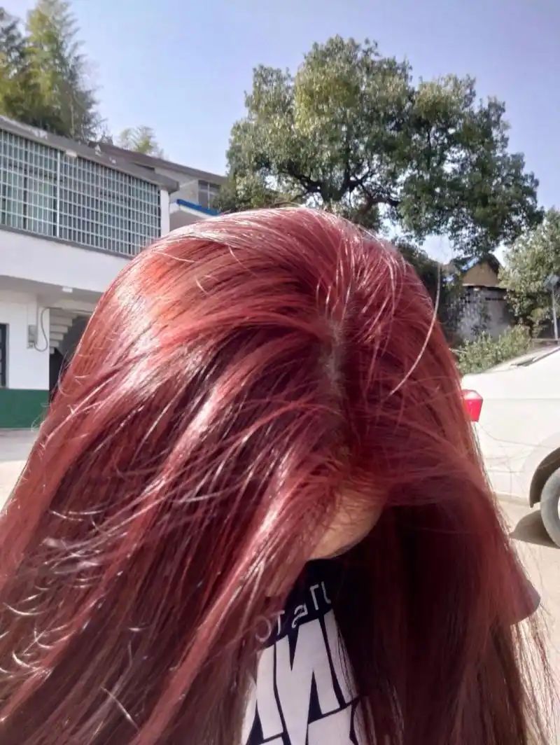 第一次在家染发,爆顶了 真的第一次尝试在家里染发,还是爆顶了,上面