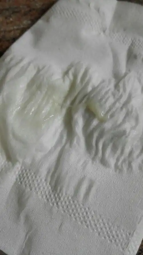 排卵期白带有血丝怎么办 排卵期分泌物有血丝是怎么回事