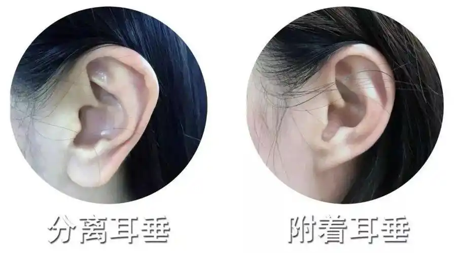 中国人的耳朵到底多大,才能有福气?_耳垂