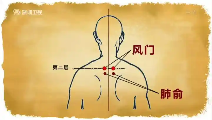 20130121深圳卫视天天养生《李智讲拔罐治疗感冒,风寒,风热》