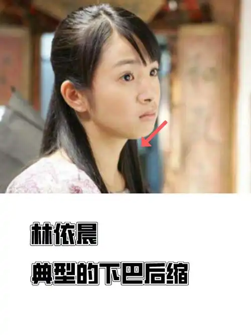 下巴后缩型发型推荐