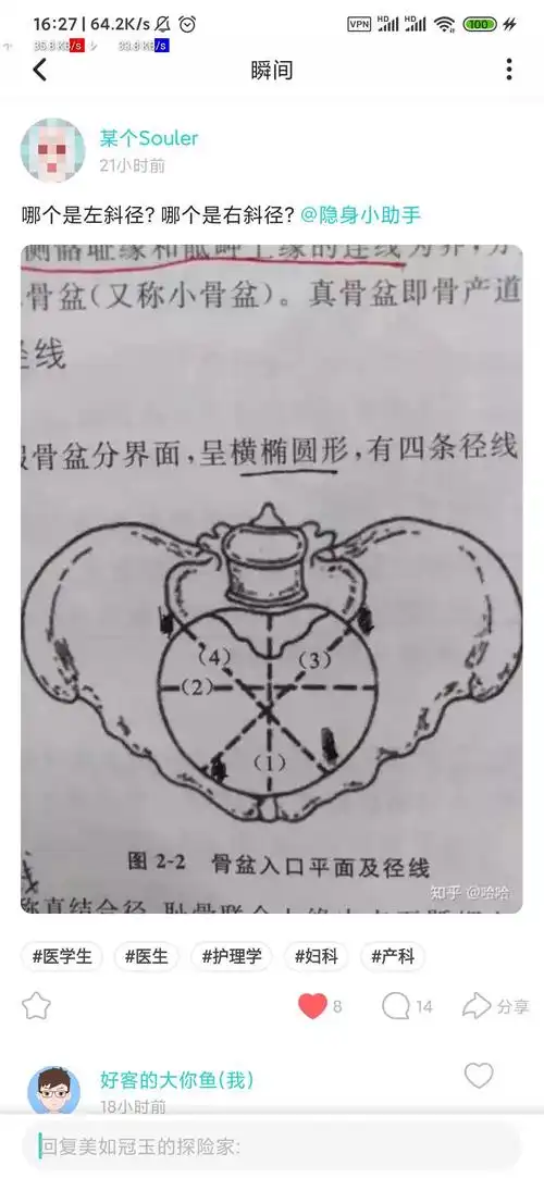骨盆入口斜径怎么区分左右斜径哪条线是左斜径哪条线是右斜径