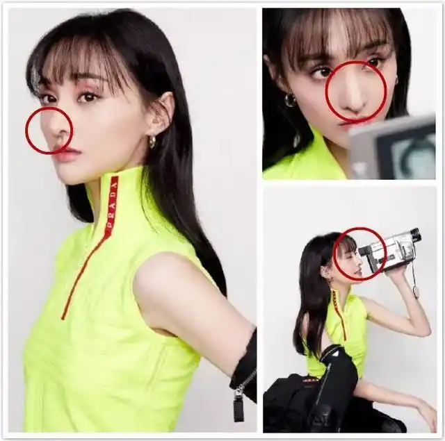 每次分手必整容郑爽最新活动照脸又变了鼻子凸起似格格巫