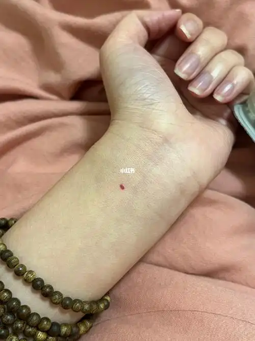 新的一年新的红痣