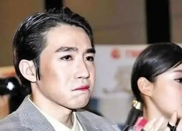 回顾娱乐圈的人情冷暖,在"烧伤"的俞灏明身上,展现得淋漓尽致