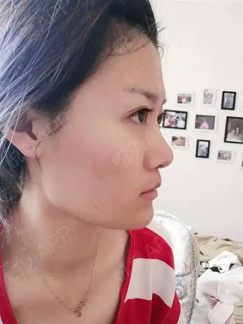 这就是同事口中的大饼脸,之前觉得没什么,看到现在的.