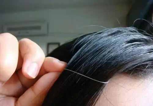 白头发「长在前额」的人要注意了!后悔那麼迟才看到这个资讯!