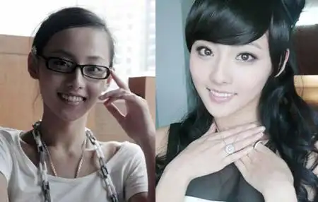 张嘉倪整容了吗宫锁珠帘袁姗姗杨幂张嘉倪整容整牙前后惊人对比照被