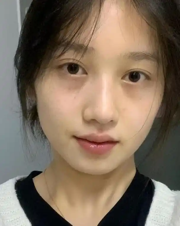 擦什么对脸部皮肤好 - 冷求网