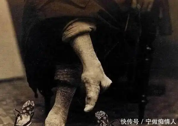 我国最后的小脚女性三寸金莲只能丈夫看如今105岁很少洗脚2