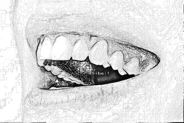 2022深圳北大医院牙齿根管做的好吗大概需要多少钱