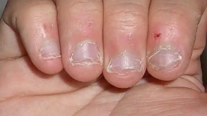 所以,要咬手指,三思而后行!