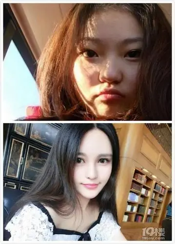 周扬青整容前照片 整容前旧照惊呆网友