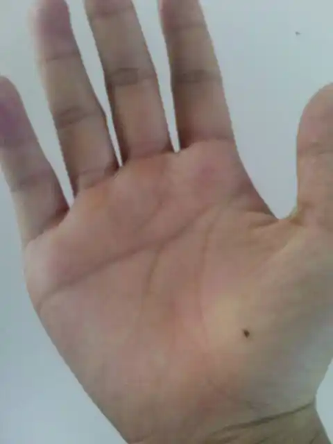 本人女,16,右手是断掌,手心有颗痣,请问是福是祸?