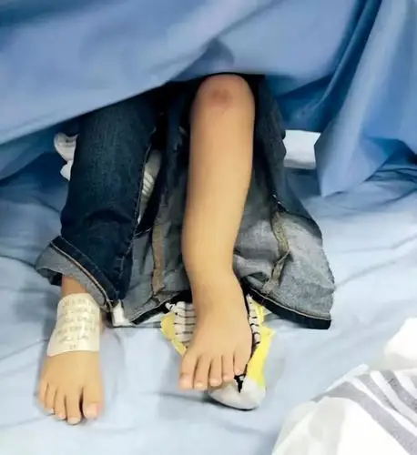 4岁女童跳弹床脚踝骨折_受伤