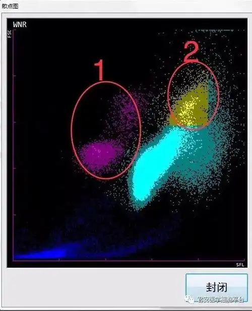 (2)正常中性细胞区域上方一出现散点异常:提示幼稚粒细胞增多,以中性