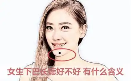 女生下巴长痣好不好有什么含义