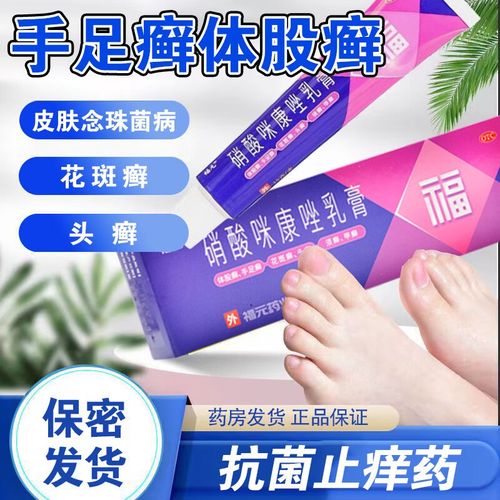 治藓药膏 硝酸咪康唑乳膏 治疗皮肤真菌感染 头藓 体股藓 体藓 手足藓
