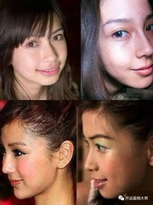 为什么大部分人都坚信angelababy整容了?