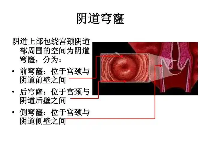 阴道穹窿 阴道上部包绕宫颈阴道 部周围的空间为阴道 穹窿,分为:   前