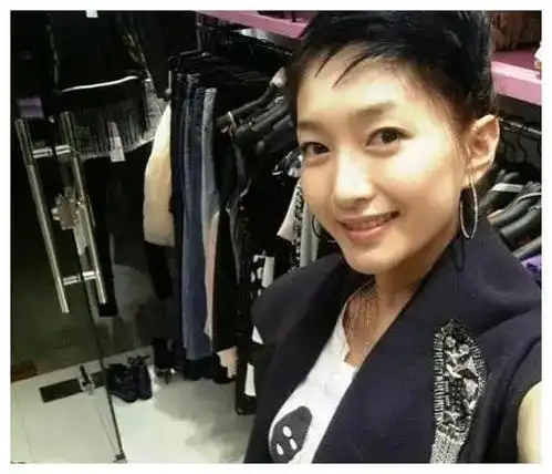 江疏影整容前旧照曝光,单眼皮宽下巴皮肤蜡黄,和如今判若两人