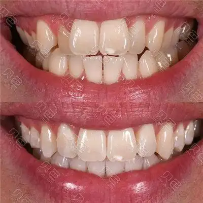 牙友告诉你到底鞍山哪里整牙好!