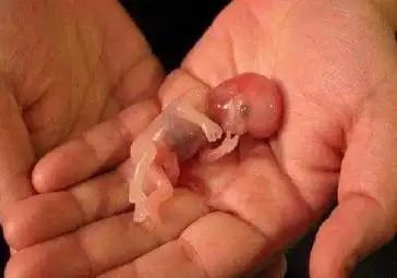 60天的胎儿,药流后被完整引出,小小模样让人心疼,父母太残忍了