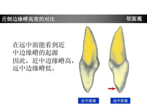 上颌中切牙形态特征简述ppt