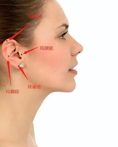 耳朵长痣好不好有什么含义女人耳朵上有痣代表什么意思