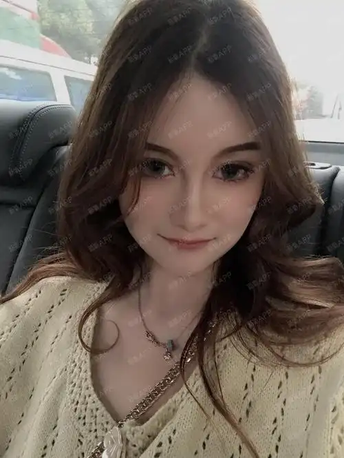 【自体脂肪全脸填充172天】