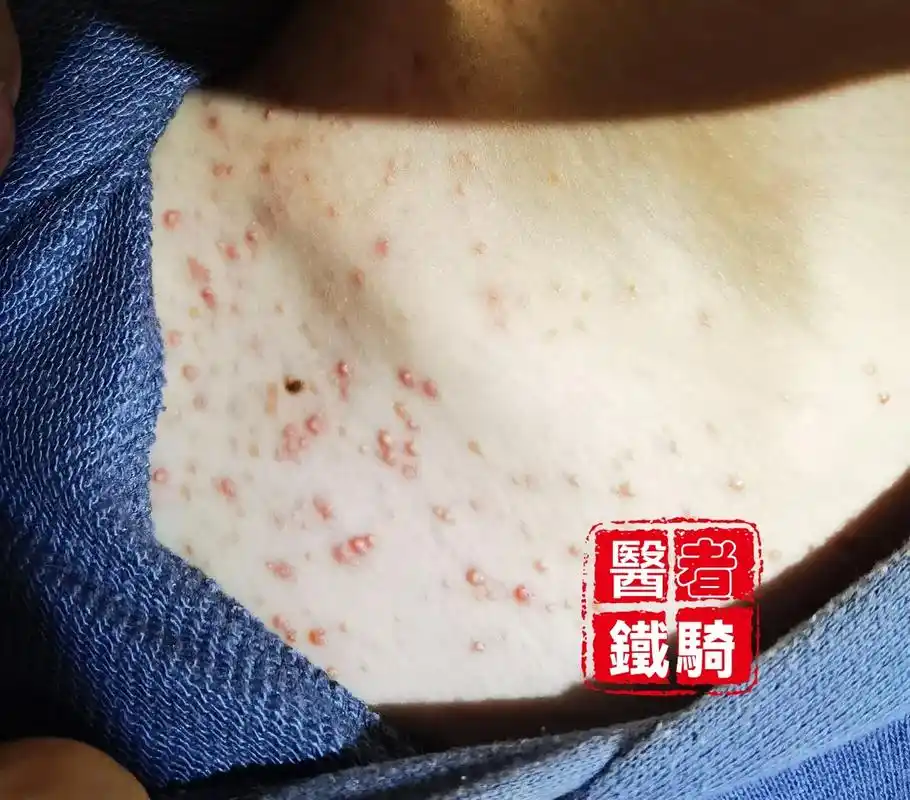 每天都接诊很多各种皮肤问题的患者,普遍存在一个现象就是皮肤刚 - 抖