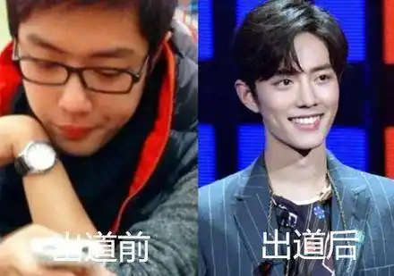 同样宅男属性的刘宇宁,没做歌手前颜值普通,还有点婴儿肥.