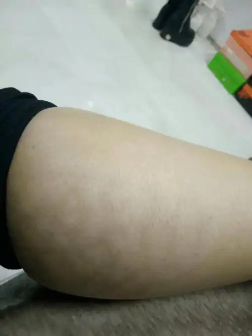 女人大腿内侧发黑,可能是这些原因,爱美的女人更要小心!