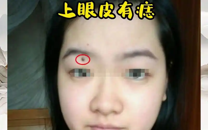 识人有术,上眼皮有痣