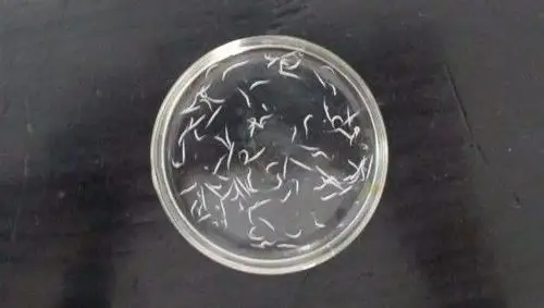 凌晨四点宝宝pp里爬出白虫,妈妈迅速送到小榄人民医院_蛲虫