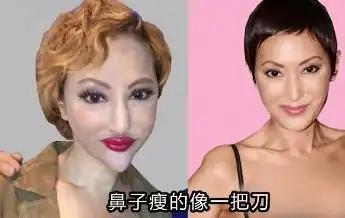 6位"整容脸"的女星,个个面部僵硬,笑比哭还难看_腾讯新闻