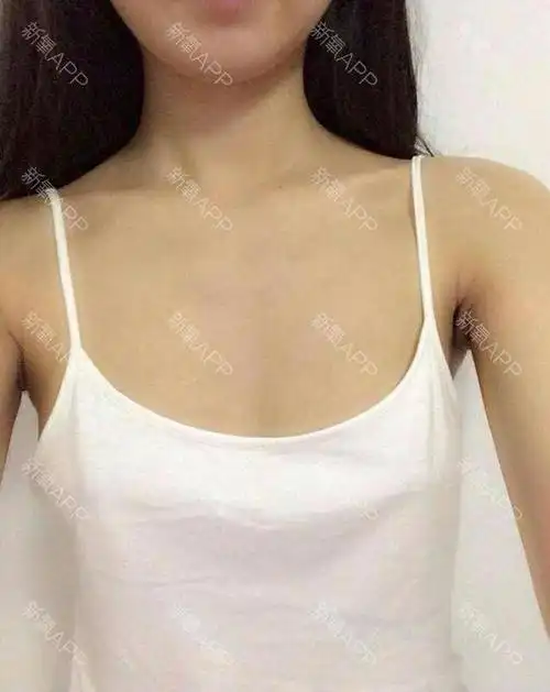 新氧的宝宝们好,今天刚做丰胸了,有点小激动,来跟大家分享一下,顺便