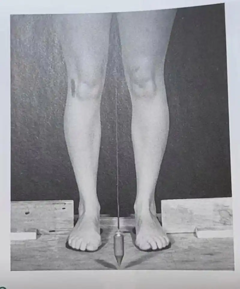 下肢力线:正面的第二张图 大家跟我一起来看一下,观察一下这个大腿根