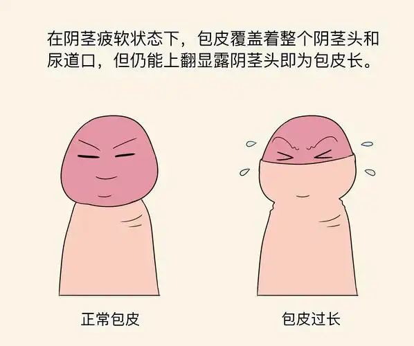 什么算包皮长.jpg