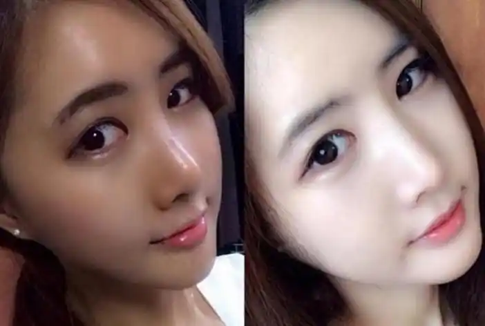 那麼,皮肤晒黑了怎麼变白呢? 一:自制香蕉牛奶面膜