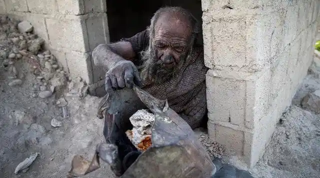 "全球最脏的人"洗澡后去世,生前只吃腐烂食物:身体很健康 免疫系统强