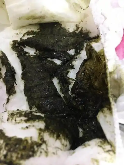 出血性胃炎,糜烂性胃炎,食管癌,胃癌,肝硬化等消化大便黑色怎么办宝