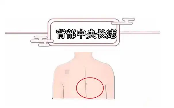 图片来源网络,如有侵权请联系站长删除一,肩胛骨有痣肩胛骨有痣的男人