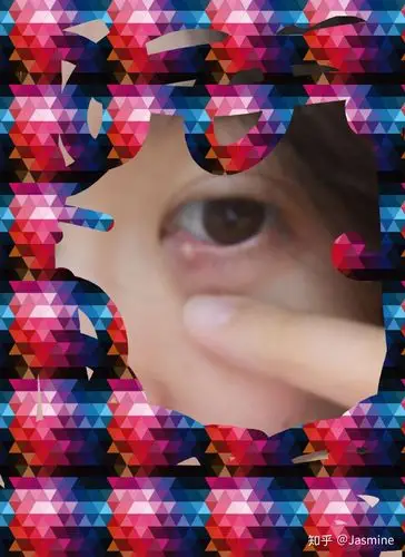 然后脓包就长出来了,开始只是一个大红包,然后就长了白点点,然后白