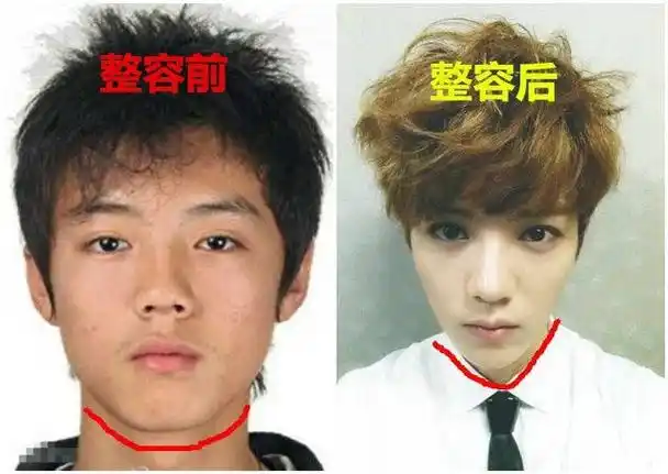 鹿晗整容前后两个人军事家庭坐拥300亿惊人身价