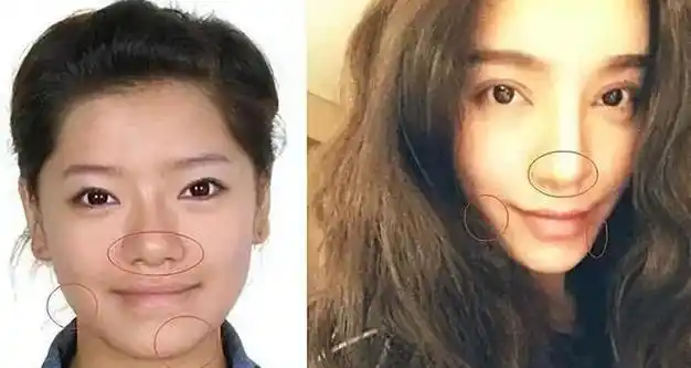 却因整容失败像"怪物",全身只有眼珠是自己的|江映蓉|尚雯婕|周笔畅