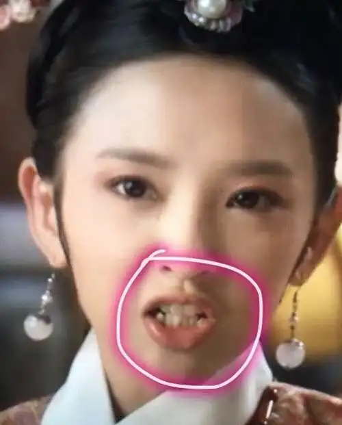 早前杨幂是有一颗小虎牙的,那时候的她非常有灵气,但拔掉后不